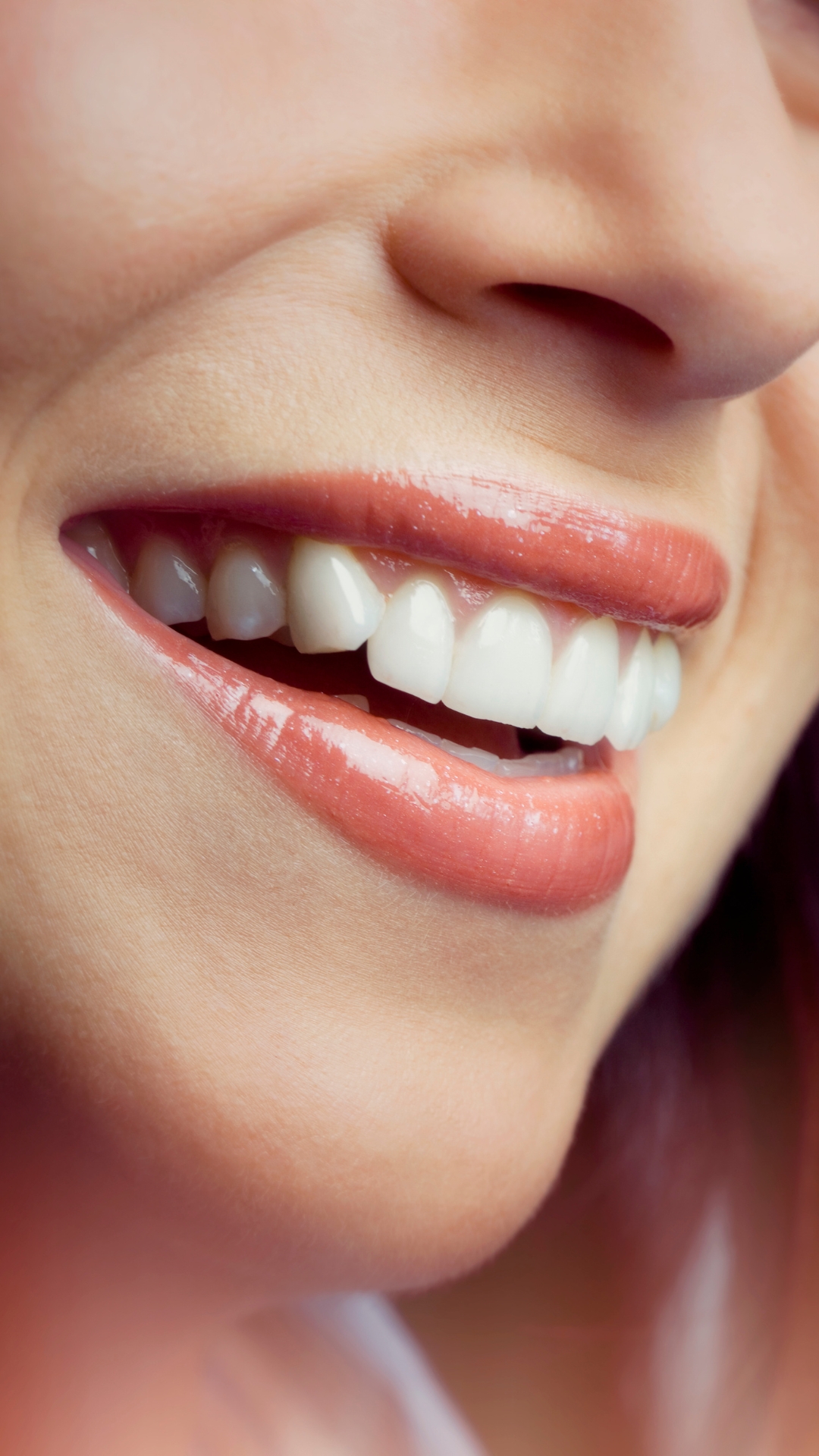 implantes dentales en Fuengirola