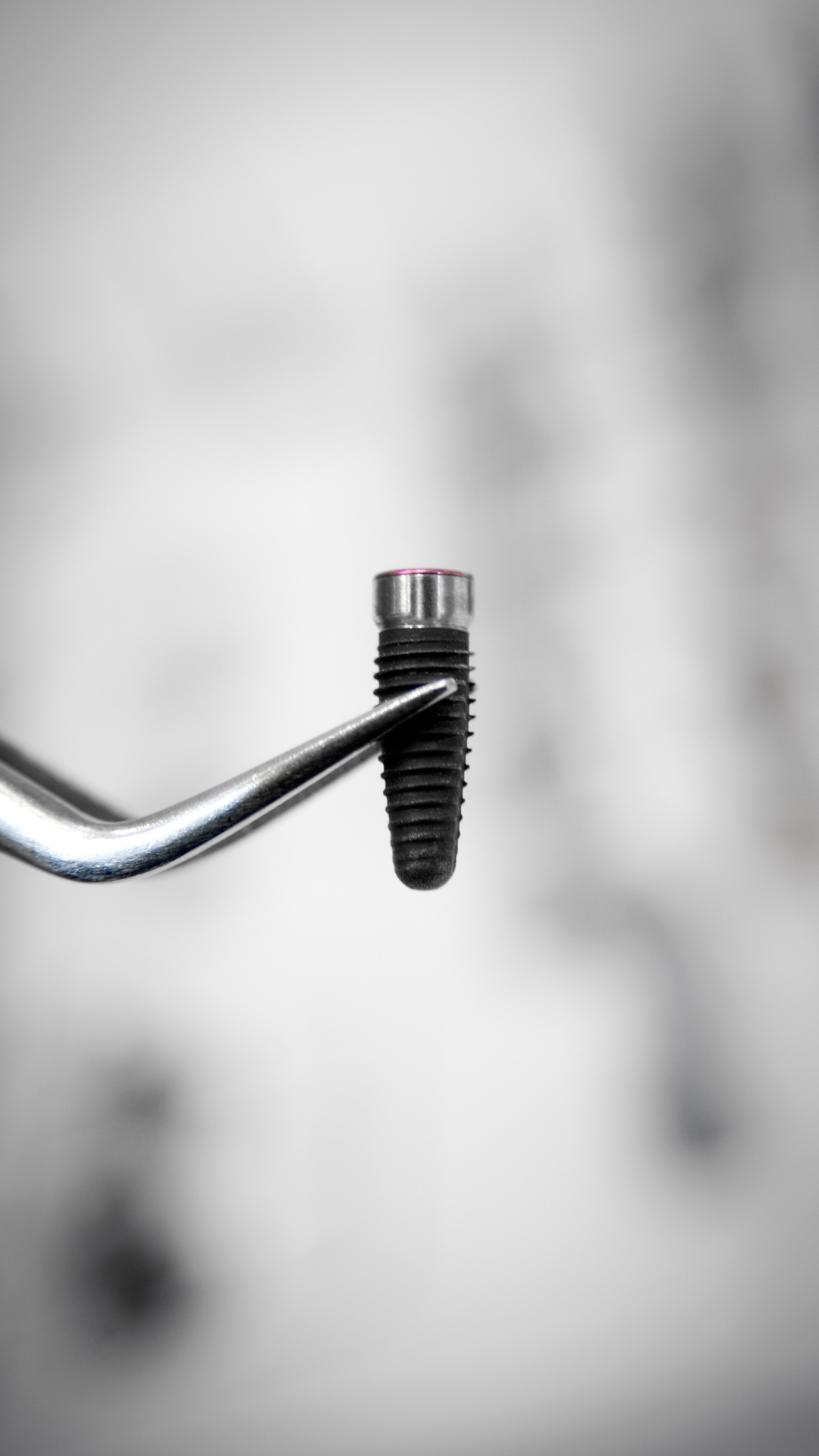 implantes dentales en Fuengirola