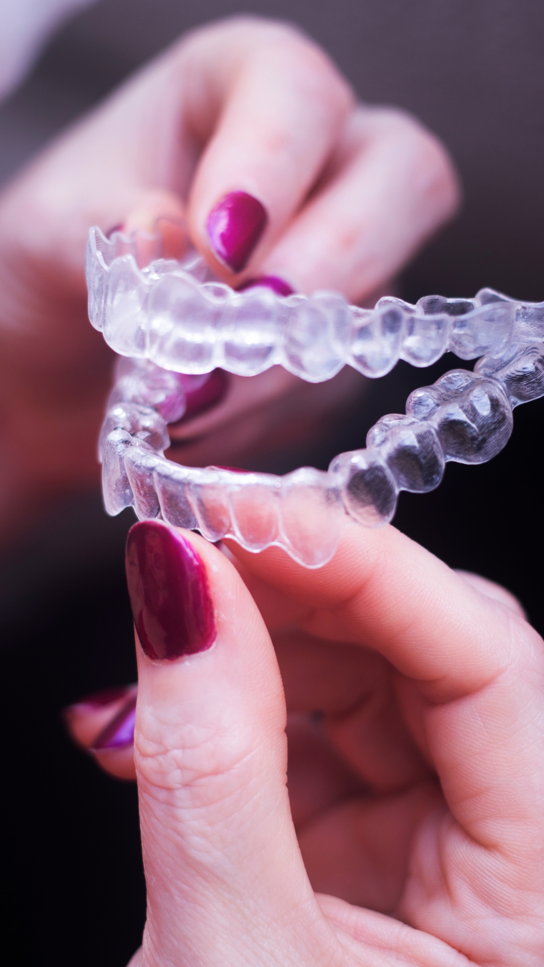 ortodoncia invisible en Fuengirola