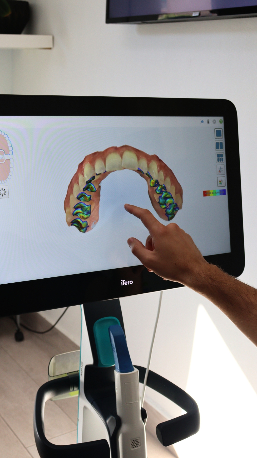 Ortodoncia invisible en Fuengirola