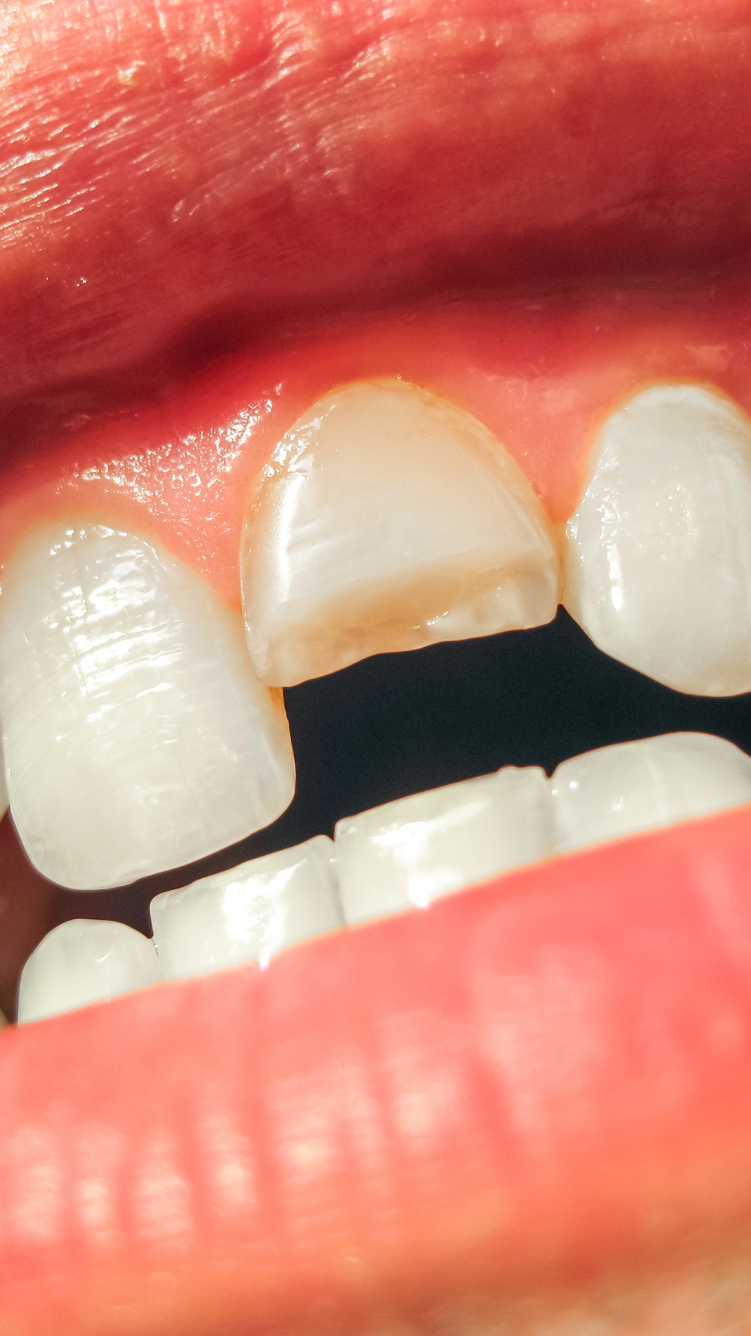 urgencias dentales en Fuengirola