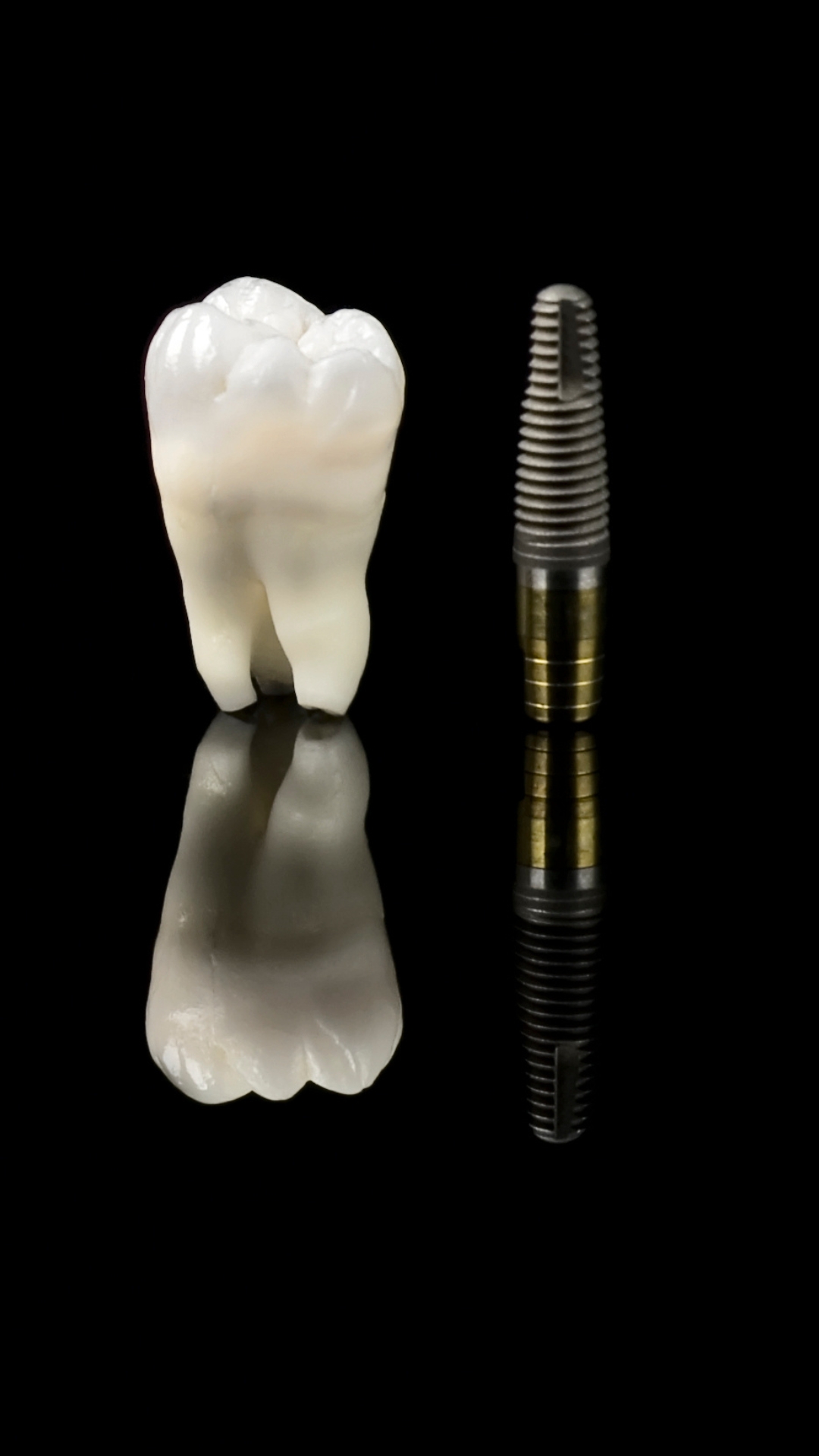 dental implants in Fuengirola