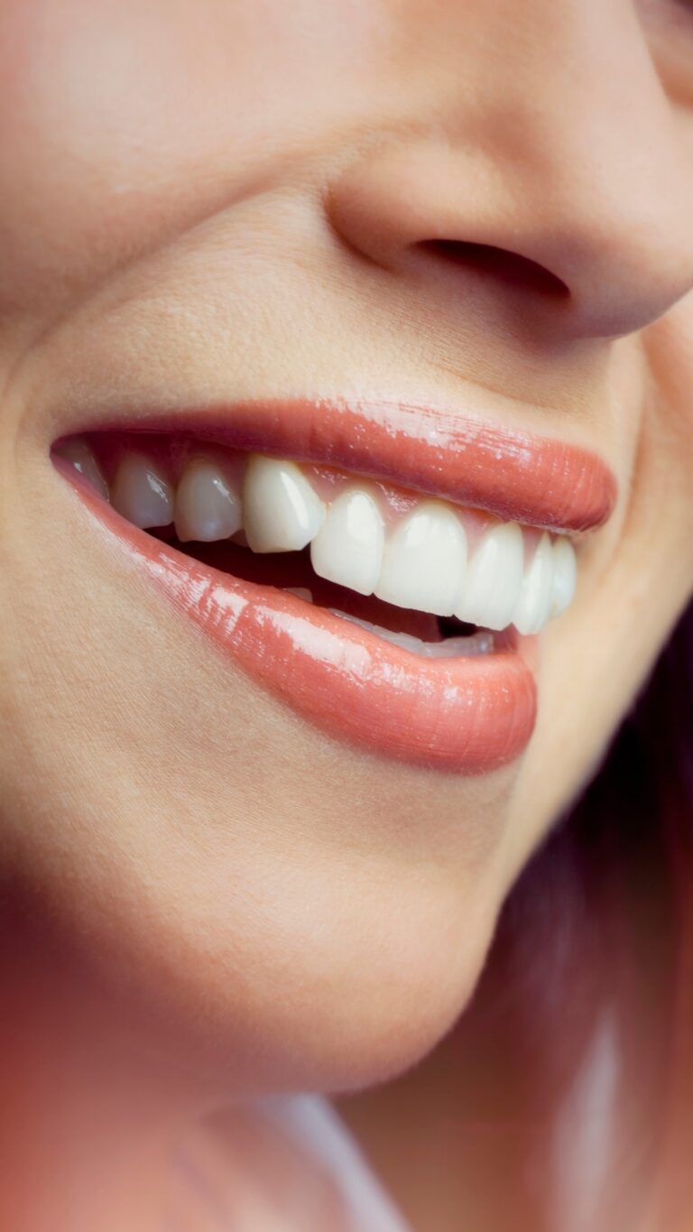 Sonrisa de una mujer con los dientes blancos y alineados