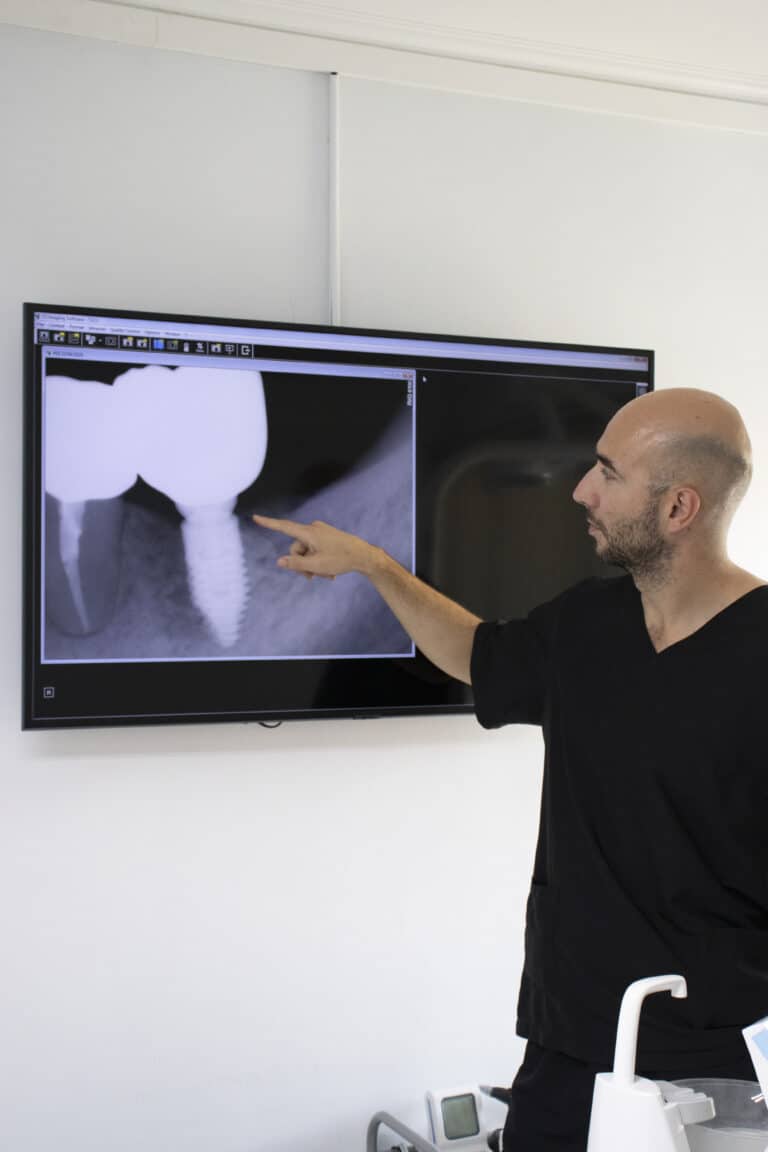 Dentista de la clínica señalando en una pantalla la radiografía de un implante dental